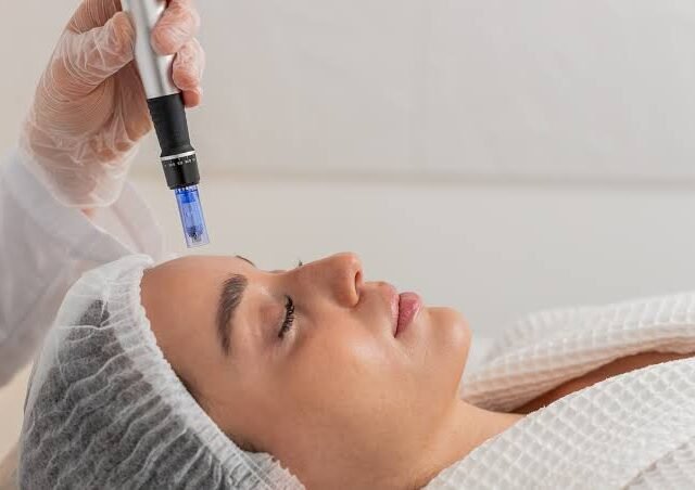 Dermapen Microneedling in Dubai: Supporting Collagen Production